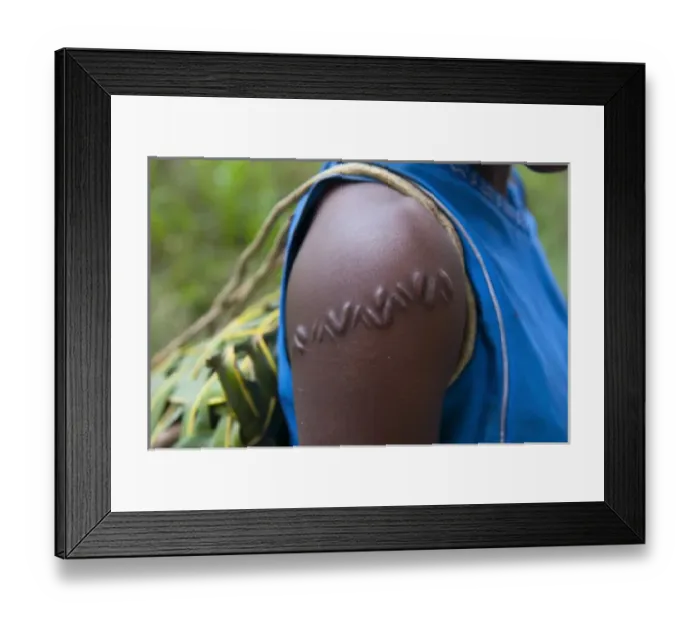 Framed Print : Local girl with typical scar near, Volcano Yasur, Island of Tanna, Vanuatu, South Pacific