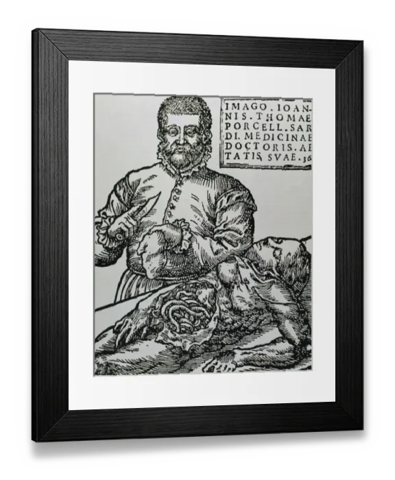 Framed Print : Porcell, John Thomas (16th century). Spanish doctor. Autopsy. Engraving Framed Print : Porcell, John Thomas (16th century). Spanish doctor. Autopsy. Engraving