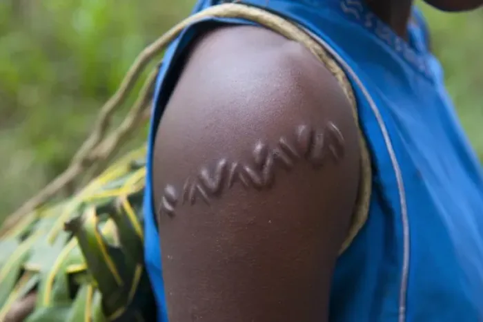 Framed Print : Local girl with typical scar near, Volcano Yasur, Island of Tanna, Vanuatu, South Pacific