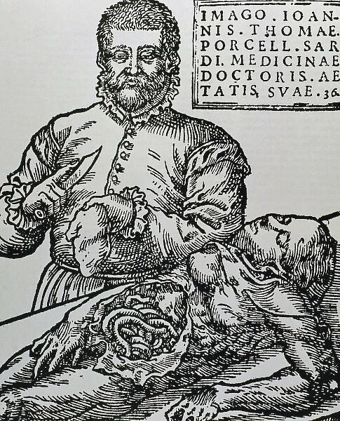 Porcell, John Thomas (16th century). Spanish doctor. Autopsy. Engraving