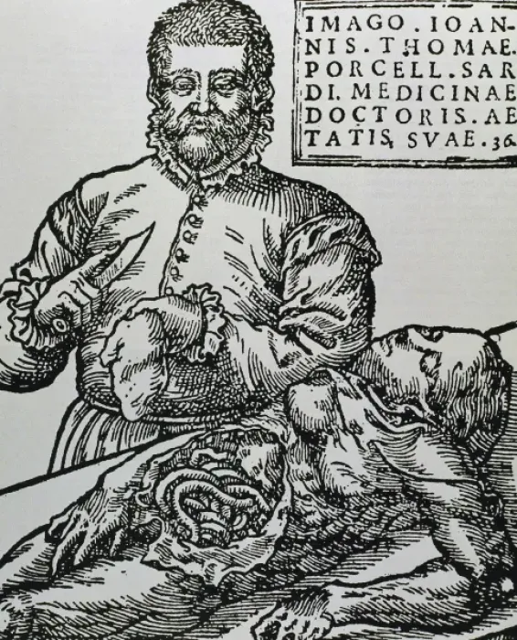 Framed Print : Porcell, John Thomas (16th century). Spanish doctor. Autopsy. Engraving Framed Print : Porcell, John Thomas (16th century). Spanish doctor. Autopsy. Engraving