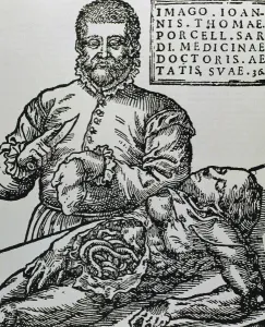 Medicine Prints: Porcell, John Thomas (16th century). Spanish doctor. Autopsy. Engraving